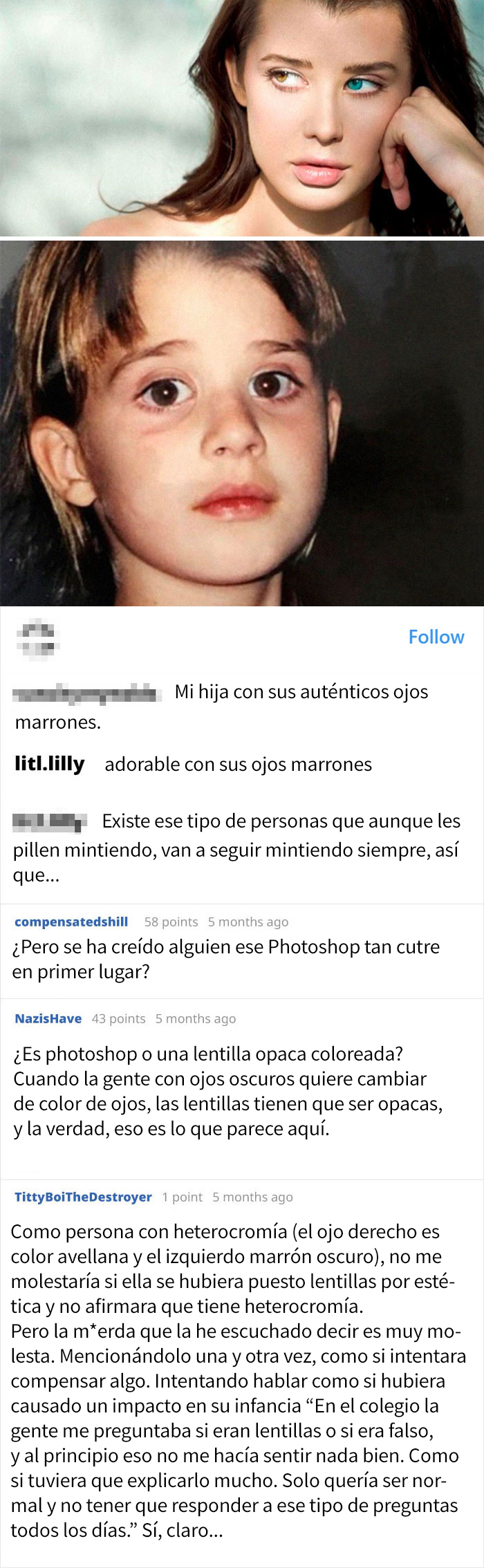Influencer Avergonzada Por Su Propio Padre Por Afirmar Que Tiene Heterocromía