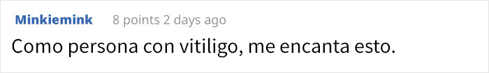 Esta gorila ha nacido sin pigmentación en los dedos y sorprende a la gente