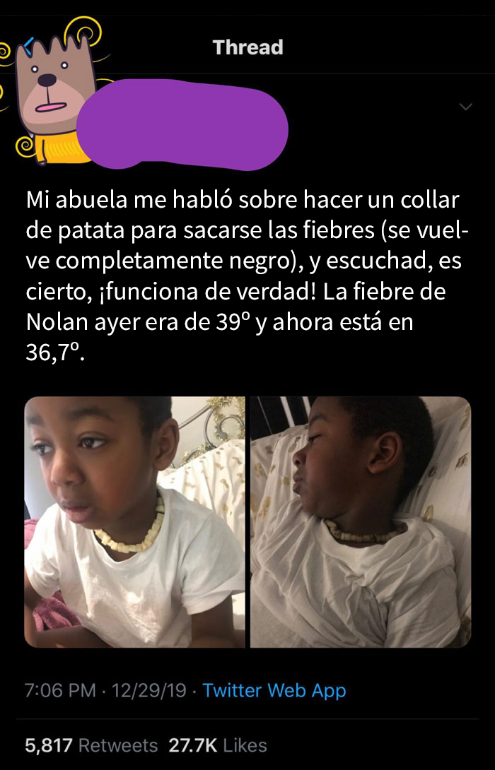 Una mujer comparte su "genial" collar de patata para curar la fiebre de su hijo y la gente se echa las manos a la cabeza