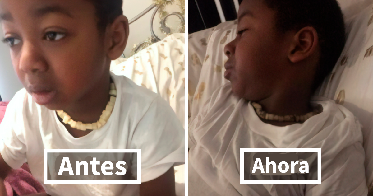 Una mujer comparte su «genial» collar de patata para curar la fiebre de su hijo y la gente se echa las manos a la cabeza