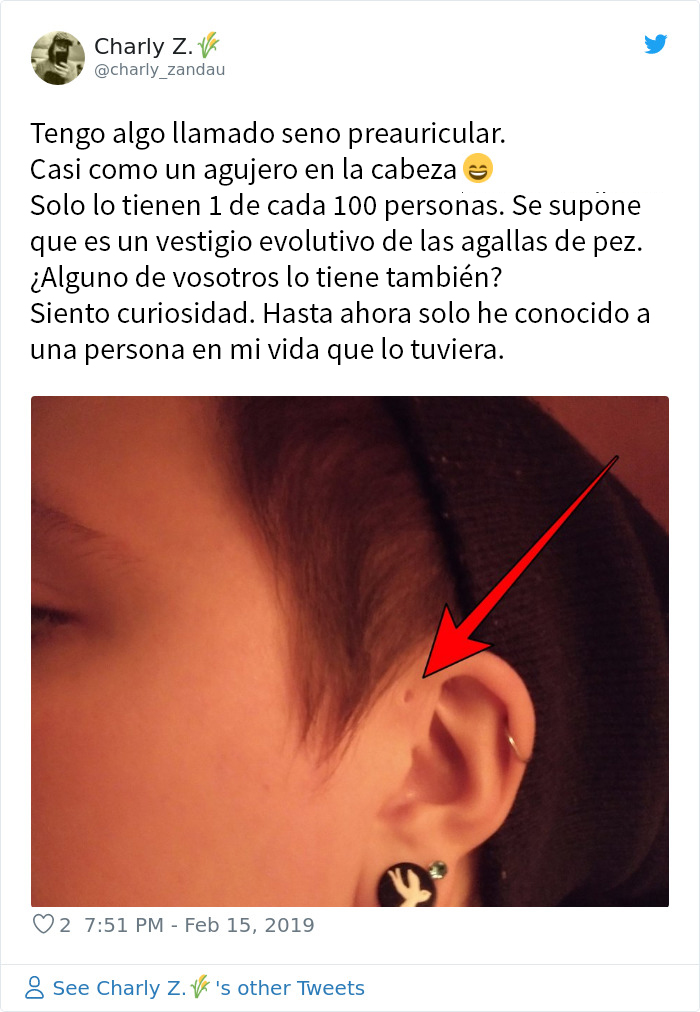 La gente se da cuenta de que estos agujeritos sobre sus orejas pueden tener una explicación evolutiva