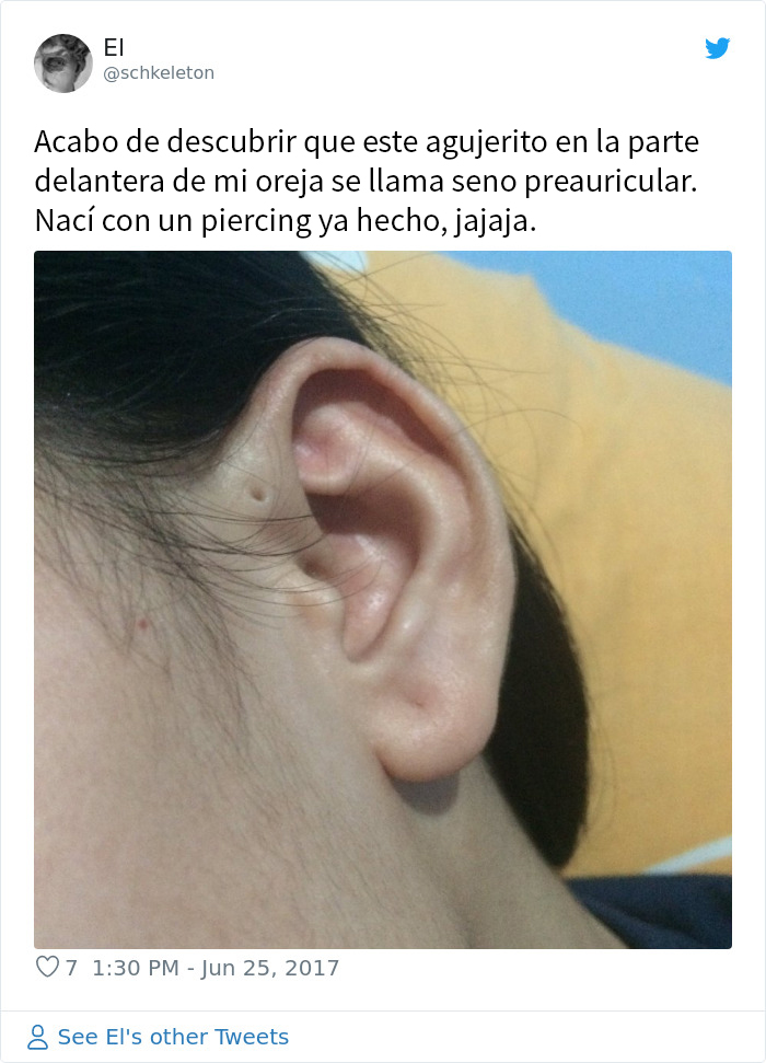 La gente se da cuenta de que estos agujeritos sobre sus orejas pueden tener una explicación evolutiva