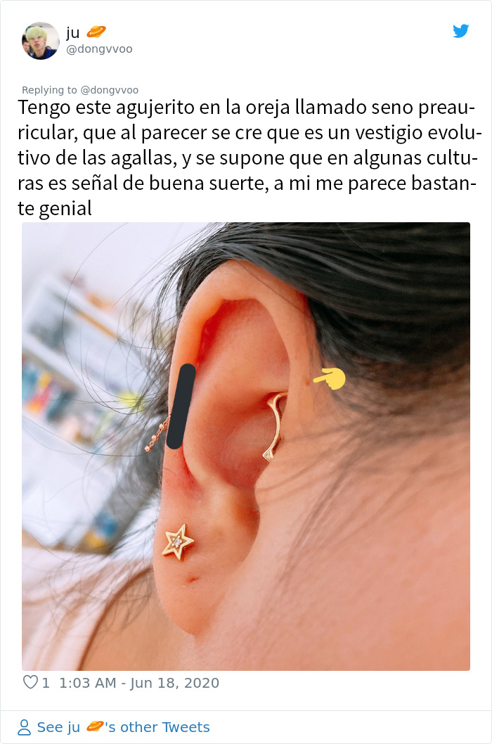 La gente se da cuenta de que estos agujeritos sobre sus orejas pueden tener una explicación evolutiva