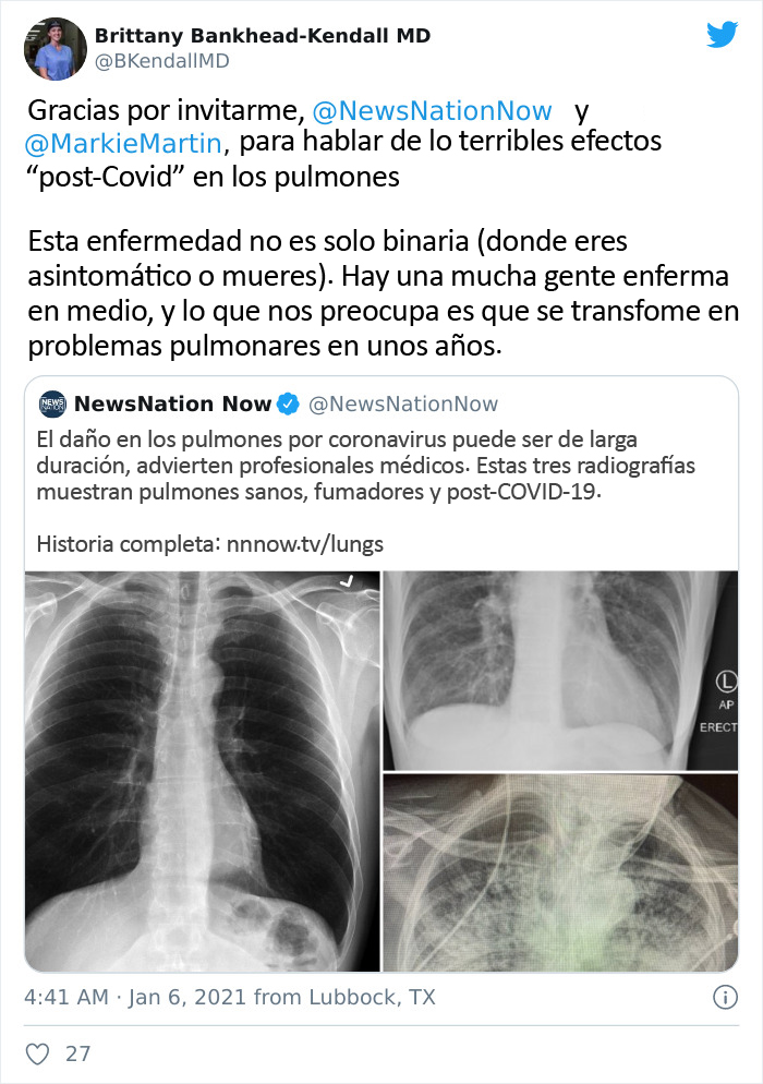 Unas radiografías muestran los efectos del COVID-19 en los pulmones comparados con los de un fumador
