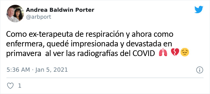 Unas radiografías muestran los efectos del COVID-19 en los pulmones comparados con los de un fumador