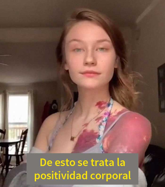 "No hay nada positivo en esto": Este chico explica cómo la gente no debería celebrar los cuerpos de "talla grande"