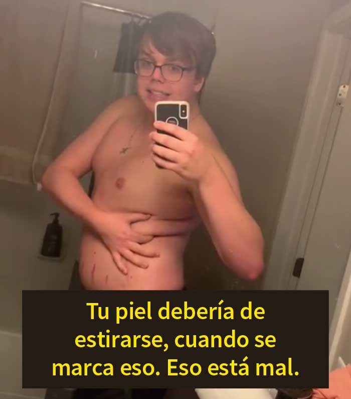 "No hay nada positivo en esto": Este chico explica cómo la gente no debería celebrar los cuerpos de "talla grande"