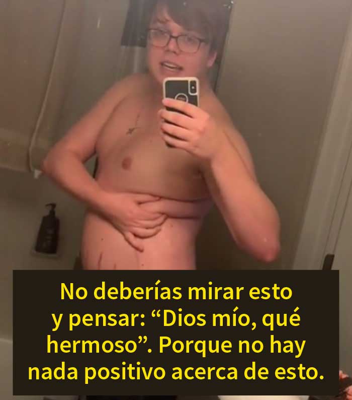 "No hay nada positivo en esto": Este chico explica cómo la gente no debería celebrar los cuerpos de "talla grande"