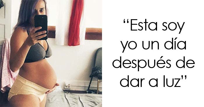 20 Fotos honestas de cuerpos postparto compartidas para mostrar la verdad de la que apenas se habla (nuevas fotos)
