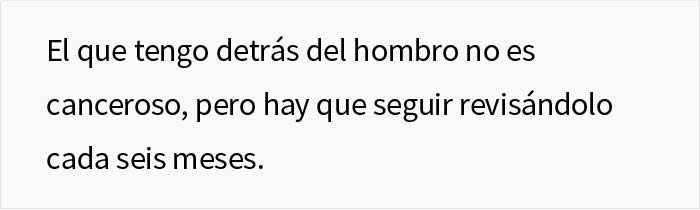 Esta esposa marcó los lunares de su marido antes de que fuera al médico y volvió con notas en su cuerpo