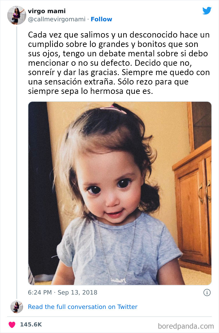 Los grandes y hermosos ojos de esta niña se deben a un raro síndrome genético llamado síndrome de Axenfeld-Rieger