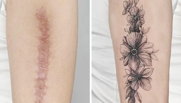 40 Personas que querían tapar sus cicatrices, y esta tatuadora lo consiguió (nuevas fotos)