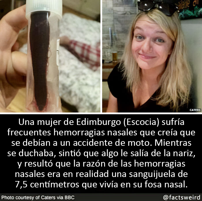 Pobre mujer