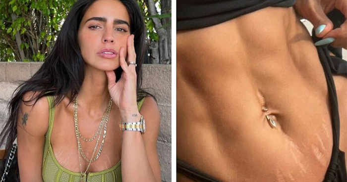 Estas celebridades latinas han elegido la positividad corporal y te animan a hacer lo mismo