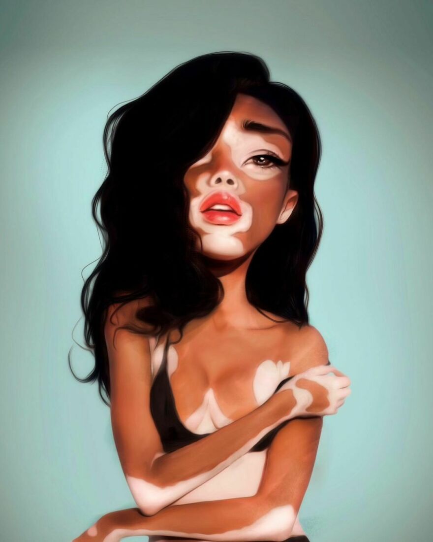 Winnie Harlow