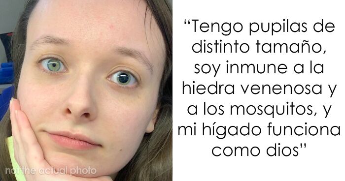 Mujer con pupilas de distinto tamau00f1o que destaca en la lista de personas con genes muy buenos o muy malos.
