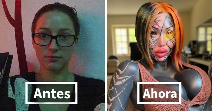 Mujer antes y despuu00e9s de cirugu00edas plu00e1sticas extremas mostrando transformaciu00f3n radical en rostro y cuerpo.