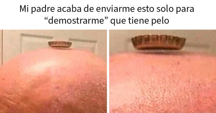Imagen meme con la tapa de botella sobre la cabeza de una persona calva, representando humor y memes aleatorios divertidos.