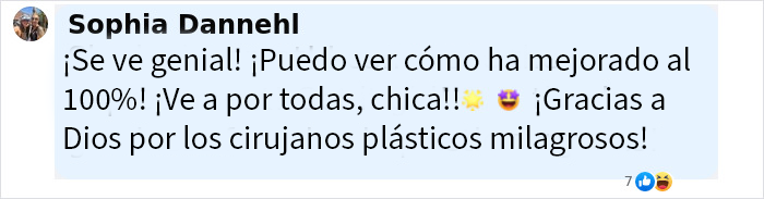 Comentario positivo sobre los resultados del lifting facial en mujer, destacando mejora y cirujanos plásticos expertos.