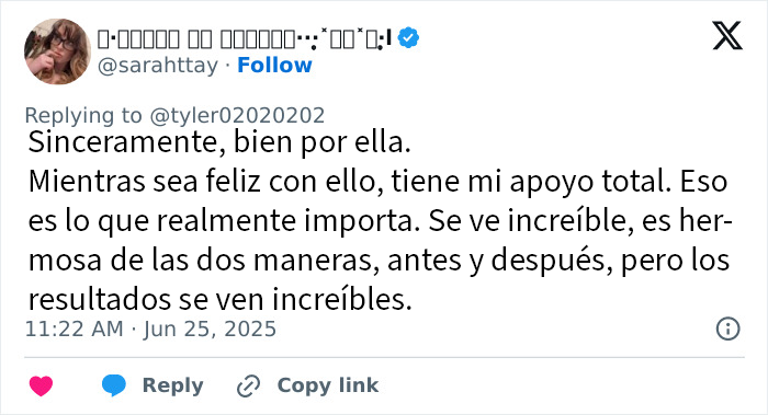 Mujer mostrando resultados sorprendentes de lifting facial por 15000 dólares, alucinando a todo internet con su cambio.