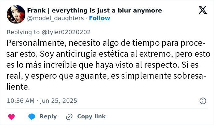 Comentario en Twitter sobre resultados de lifting facial en mujer mostrando sorpresa y opinión contraria a la cirugía estética.
