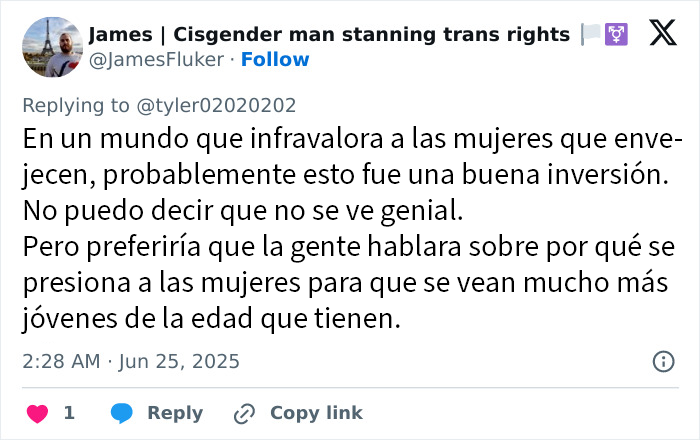 Mujer mostrando los resultados del lifting facial que se hizo por 15000$, sorprendiendo a todo internet con su cambio.
