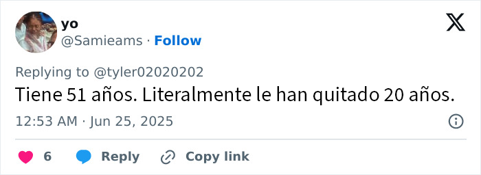 Mujer mostrando los resultados sorprendentes de un lifting facial valorado en 15000 dólares que ha impactado en internet.