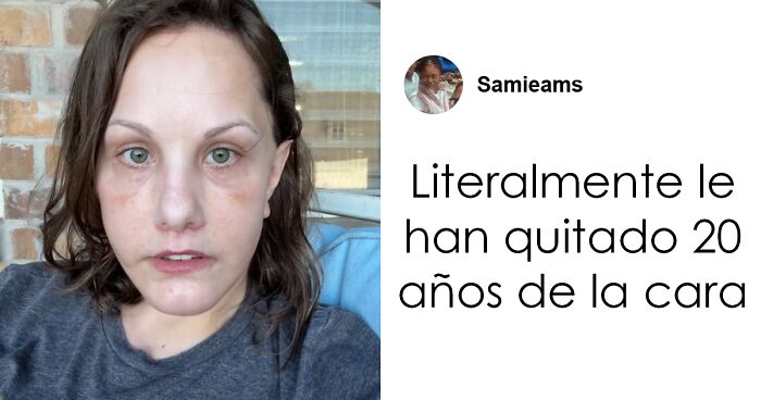 Mujer mostrando resultados del lifting facial que rejuvenecieron su rostro y sorprendieron en internet.