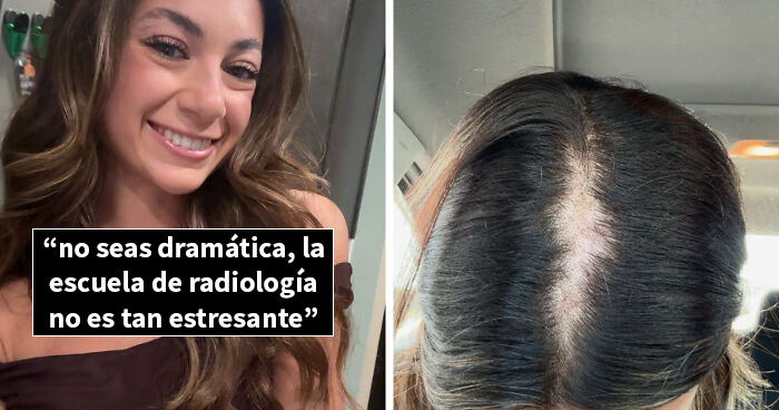 Mujer mostrando su cambio físico en fotos de antes y después, reflejando cómo la vida les pasa por encima.