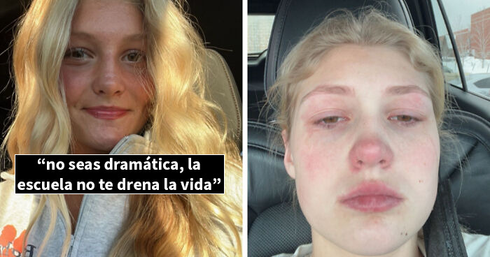 Joven muestra contraste antes y después, reflejando el impacto de la vida en estas fotos de antes y después.