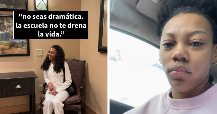 Mujer muestra cambio visible en su rostro en fotos de antes y después que la vida les pasara por encima.