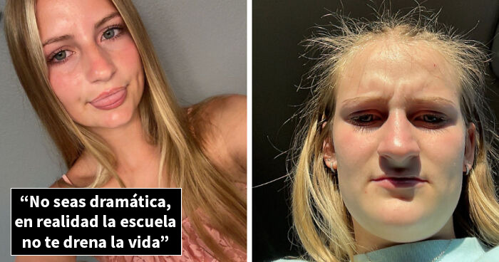 Comparación de antes y después mostrando cambios reales en personas tras que la vida les pasara por encima.