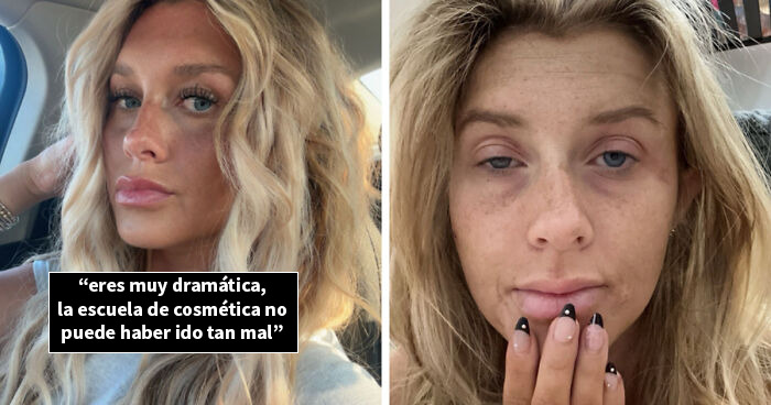 Persona mostrando fotos de antes y después, reflejando cambios reales y experiencias de vida visibles en su rostro.