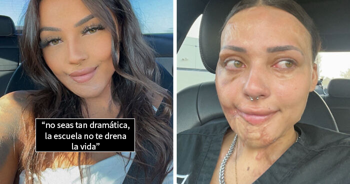 Mujer mostrando fotos de antes y después, reflejando cambios en la vida y superación personal con fotos impactantes.