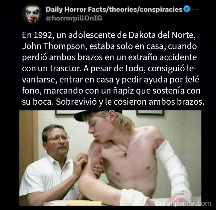 Adolescente de Dakota con heridas graves en brazos tras accidente, historia real terrorífica y datos impactantes para no dormir.