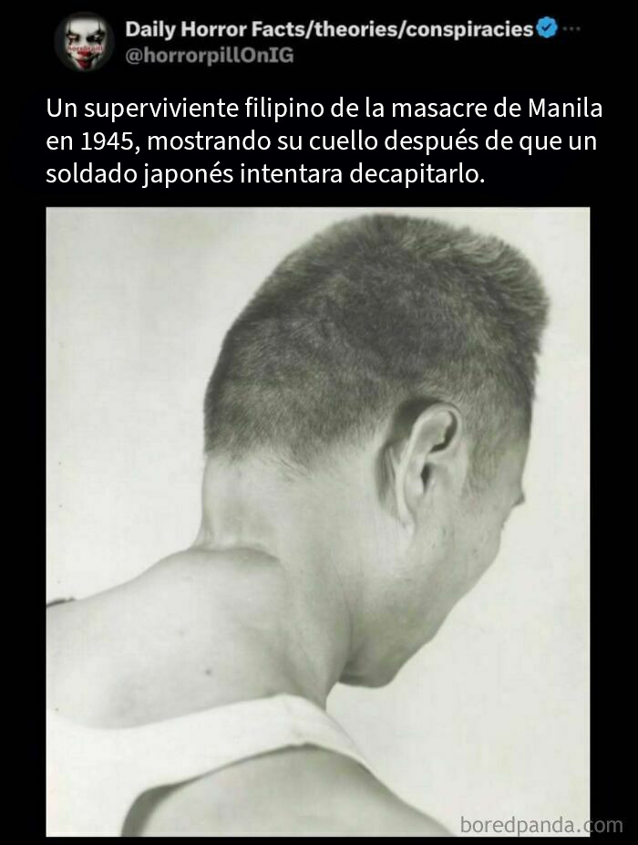 Superviviente de la masacre de Manila en 1945 mostrando herida en el cuello, imagen terrorífica para no leer antes de dormir.