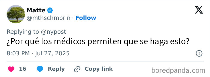 Mujer con los labios más grandes del mundo antes y después de gastar 26000 dólares en cirugías extremas.
