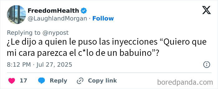 Mujer con los labios más grandes del mundo muestra su transformación tras cirugías extremas y costosas.