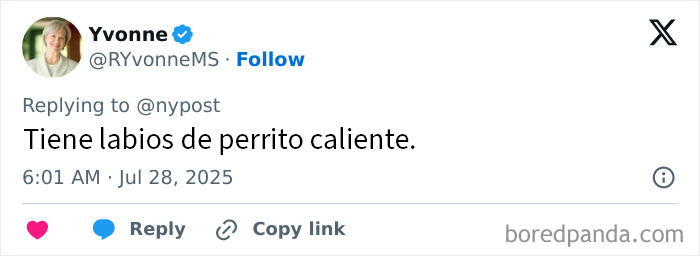 Tuit con comentario sobre mujer con los labios más grandes del mundo y sus cirugías extremas por 26000 dólares.