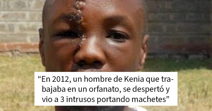 Hombre de Kenia con cicatriz en el rostro, relacionado con datos curiosos y morbosos que no son aptos para cardu00edacos.