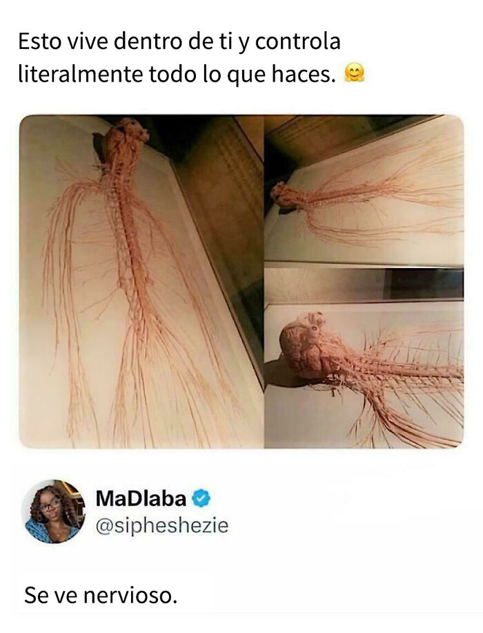 Estructura nerviosa humana ampliada con texto humorístico sobre publicaciones hilarantemente estúpidas que merecen votos enojados.