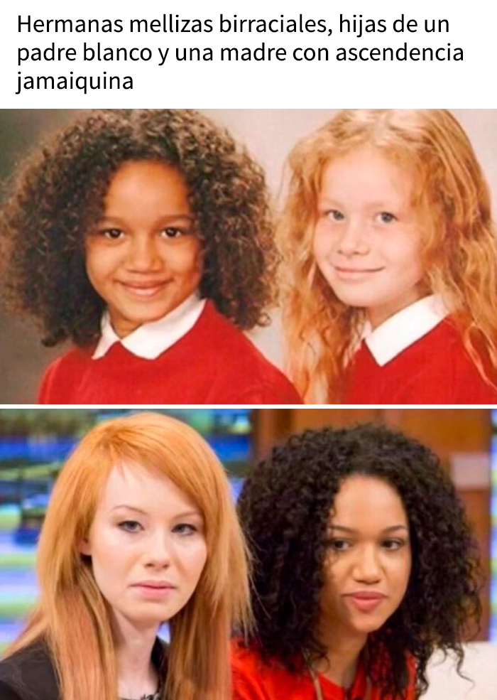 Hermanas gemelas birraciales en dos etapas de la vida, ilustrando historias impactantes sobre perder la movilidad por bebidas energéticas.