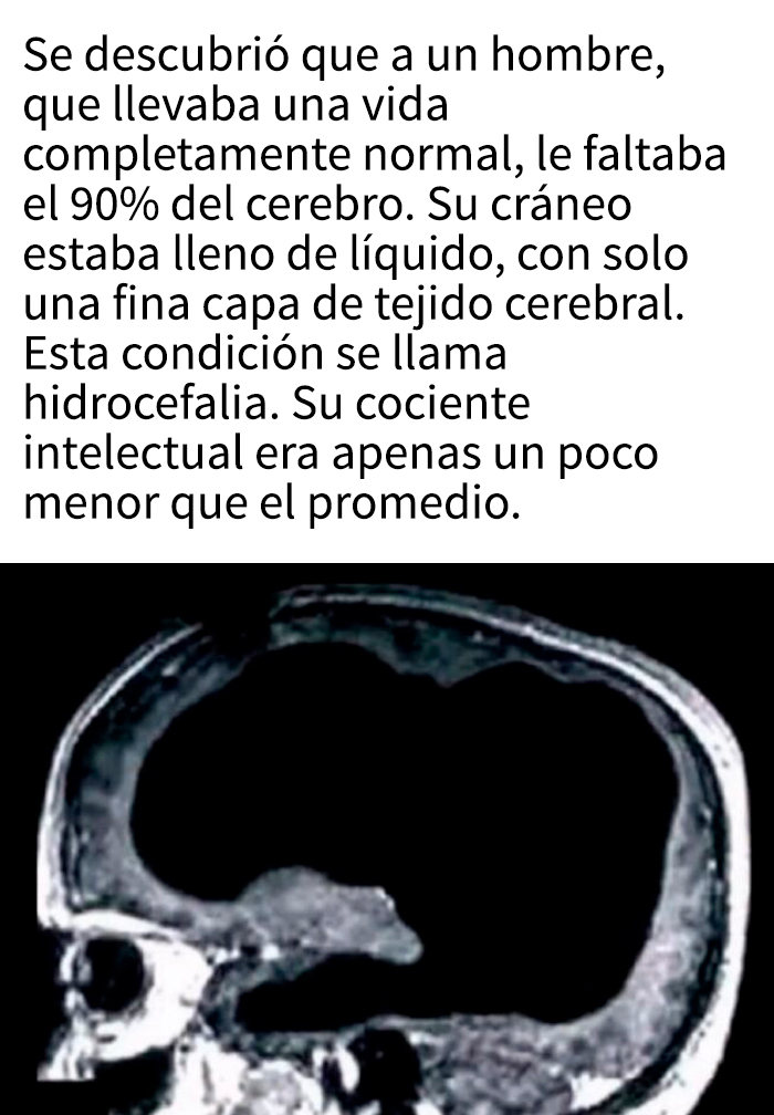 Hombre pierde la habilidad para caminar por consumo excesivo de bebidas energéticas según historias impactantes.