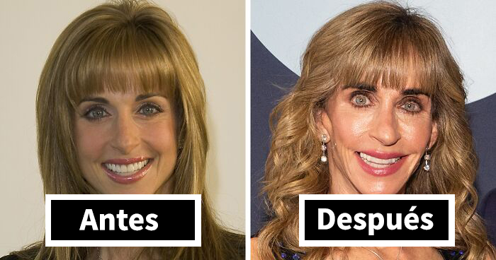 10 transformaciones faciales a lo “Mar-a-Lago” que dejaron a la gente completamente atónita