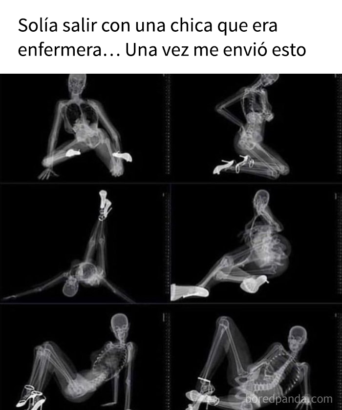 Radiografías de esqueletos en poses divertidas, reflejando el humor oscuro y memes hilarantes para quienes disfrutan ese estilo.