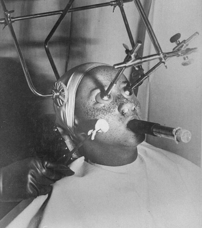 Procedimiento de congelación de pecas en 1930