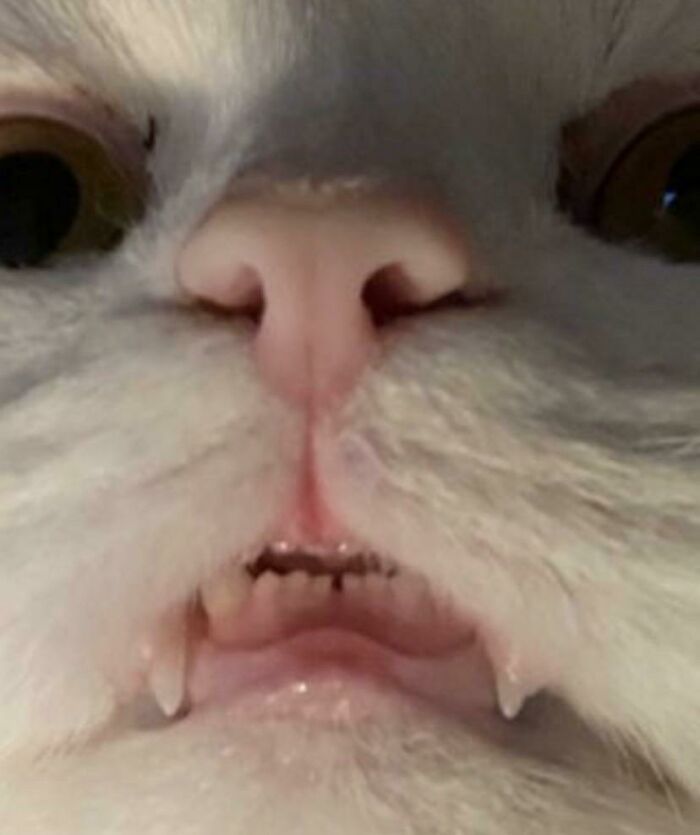 Los espacios entre los dientes son hermosos