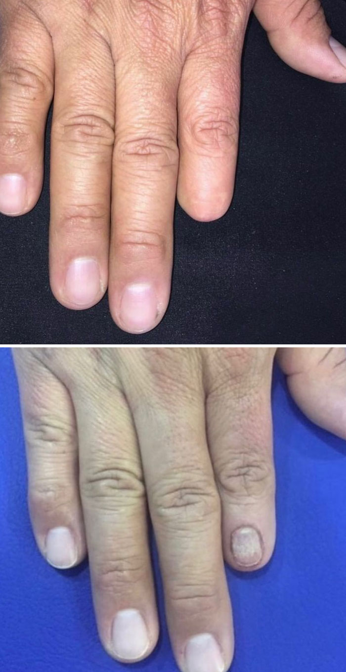 Mira esta increíble foto de antes y después de nuestro artista, Gustavo