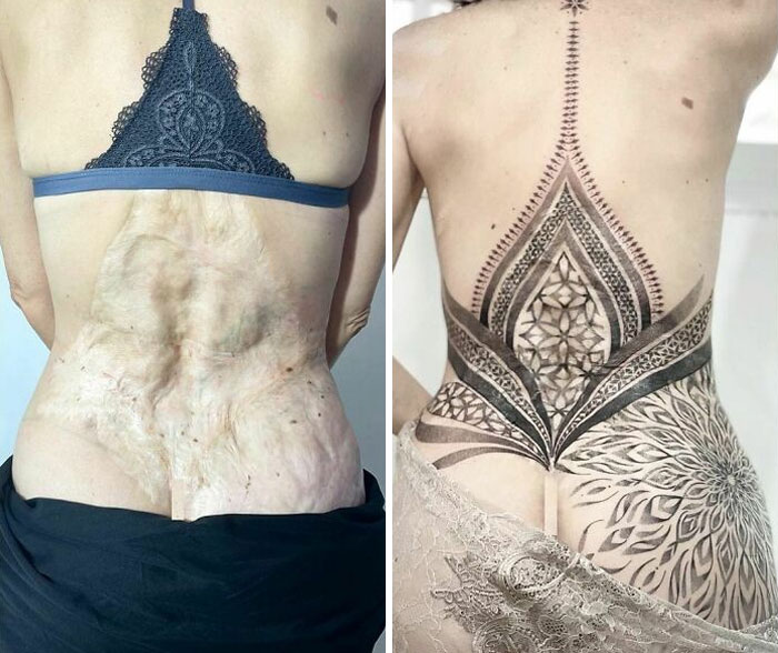 El tatuaje más significativo que he hecho. Cubrir una cicatriz para esta increíble mujer. No tengo palabras para describir este proceso