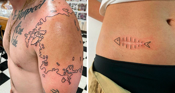 40 Personas que pidieron a tatuadores que cubrieran sus cicatrices y marcas de nacimiento y no pudieron estar más contentos con el resultado